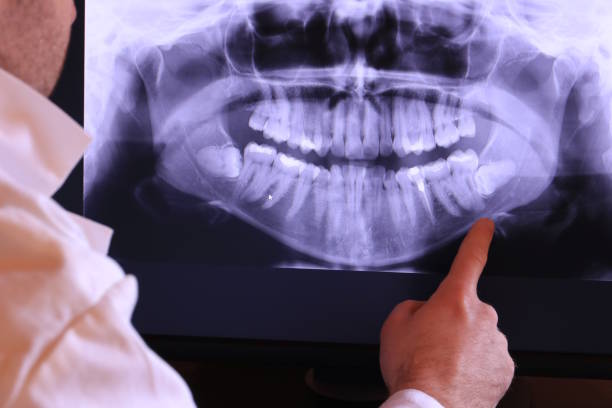 Best Emergency Care for Gum Disease in Port Allegany, PA